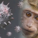 Maymun Çiçeği Hastalığıyla İlgili Bilinmesi Gerekenler