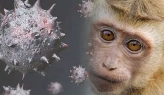 maymun çiçeği hastalığı nedir