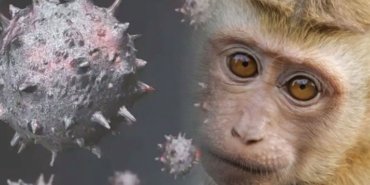 maymun çiçeği hastalığı nedir