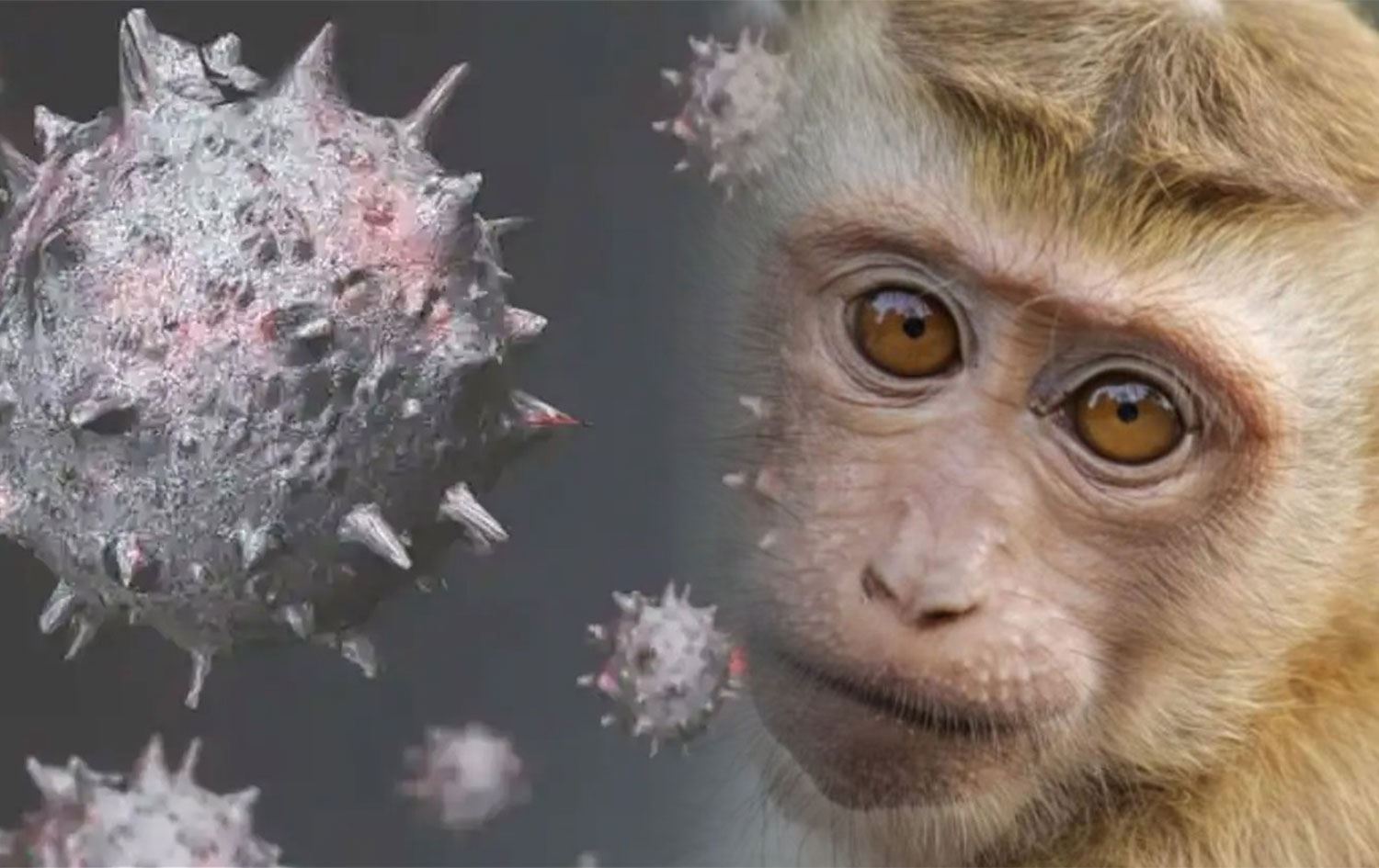 Maymun Çiçeği Hastalığıyla İlgili Bilinmesi Gerekenler