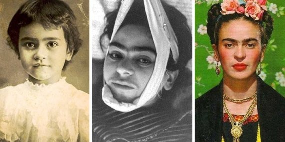Ünlü Ressam Frida Kahlo’nun Hayat Hikayesi